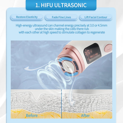 Mini HIFU Facial Lifting Device — RF, EMS & Ultrasonic Skin Tightening for Face, Chin, Neck & Eyes