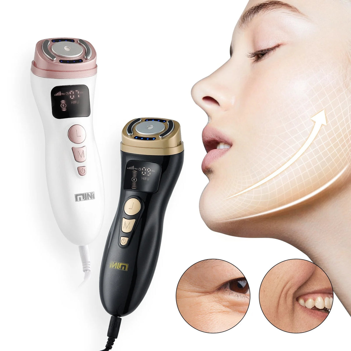 Mini HIFU Facial Lifting Device — RF, EMS & Ultrasonic Skin Tightening for Face, Chin, Neck & Eyes